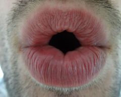 'Husten, wir haben ein Problem!'